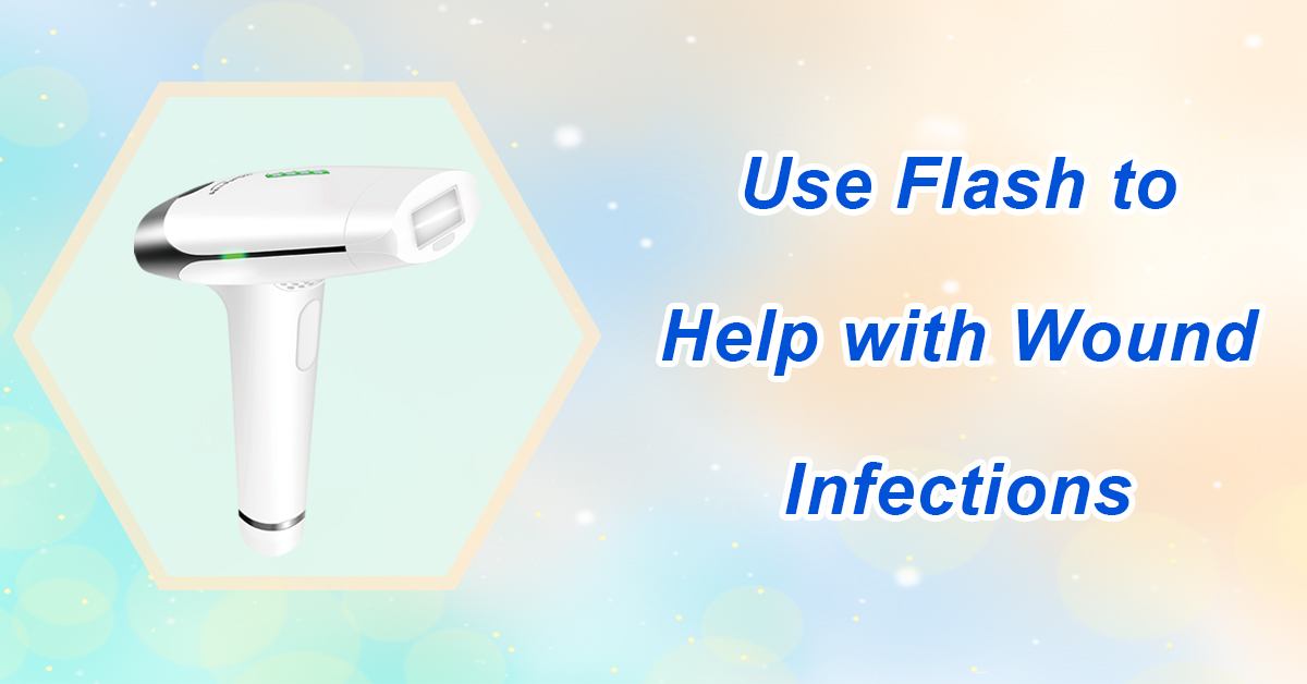 Use Flash to Help with Wound Infections