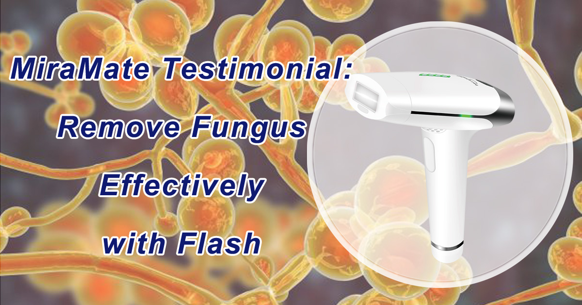 Remove Fungus Effectively with Flash