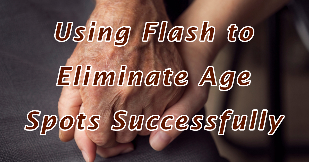 Using Flash to Eliminate Age Spots Successfully