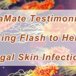 Using Flash to Help Fungal Skin Infections