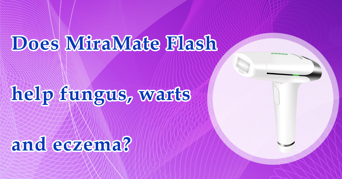 Does MiraMate Flash help fungus, warts and eczema
