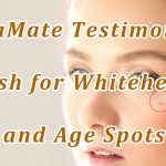 Flash for Whiteheads and Age Spots