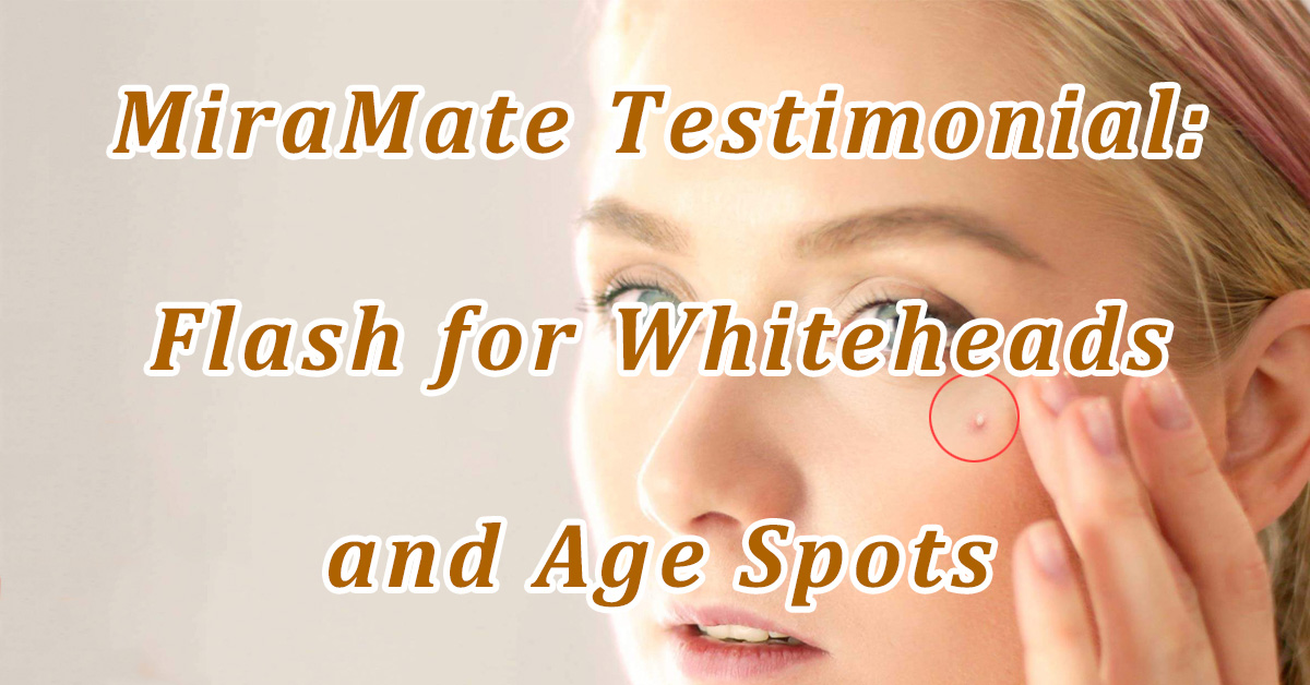 Flash for Whiteheads and Age Spots