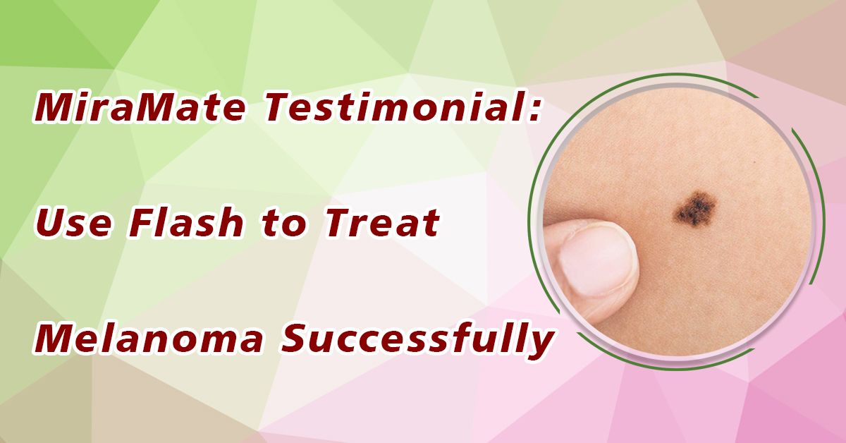 Use Flash to Treat Melanoma Successfully