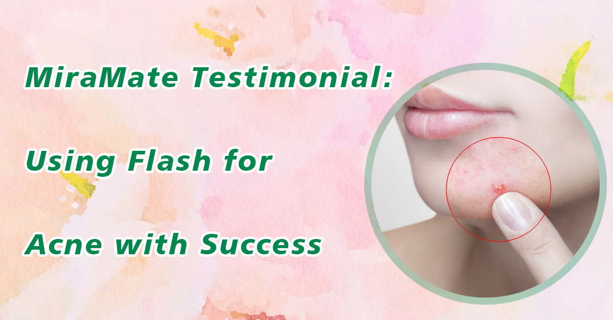 Using Flash for Acne with Success