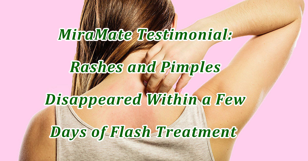 Rashes and Pimples Disappeared Within a Few Days of Flash Treatment