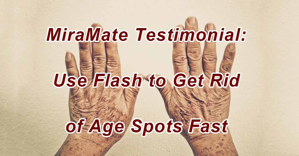 Use Flash to Get Rid of Age Spots Fast