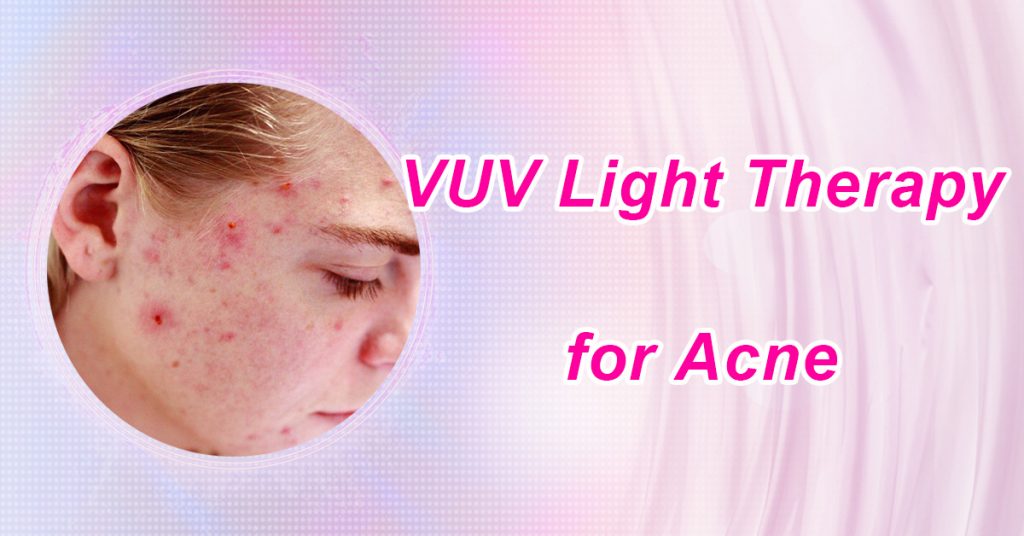 VUV Light Therapy for Acne