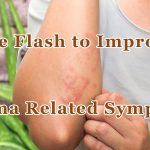 Use Flash to Improve Eczema Related Symptoms