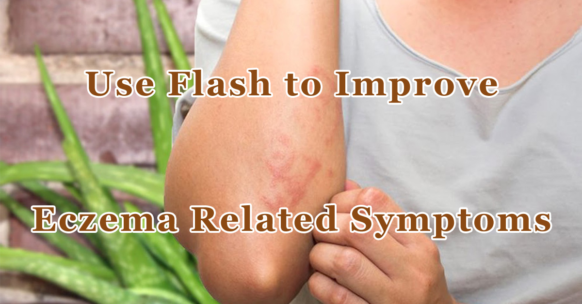 Use Flash to Improve Eczema Related Symptoms