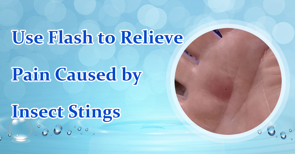 Use Flash to Relieve Pain Caused by Insect Stings