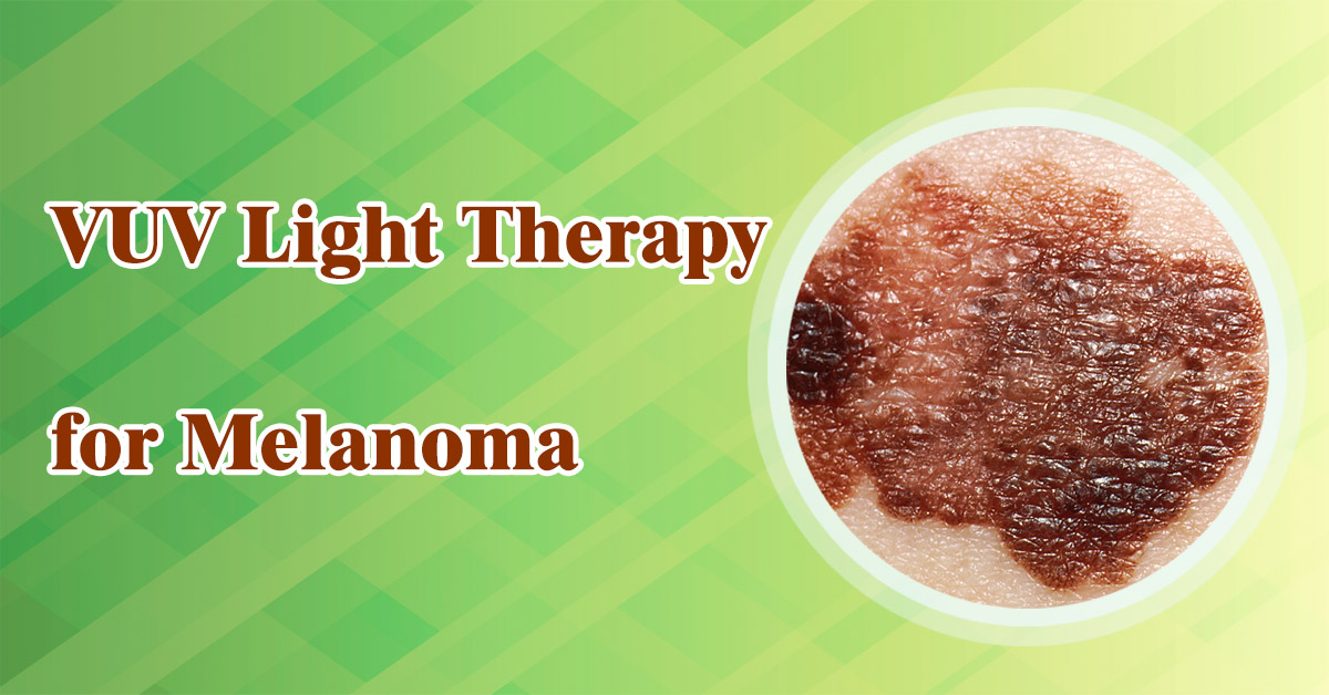 VUV-lichttherapie voor melanoom