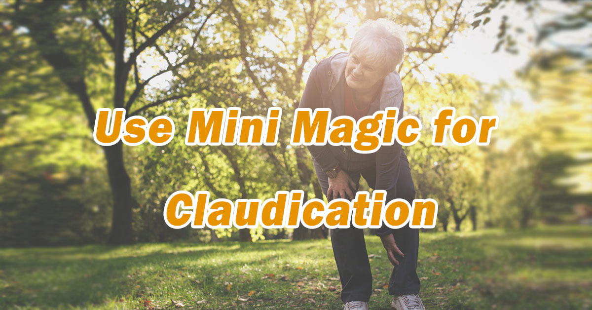 Use Mini Magic for Claudication