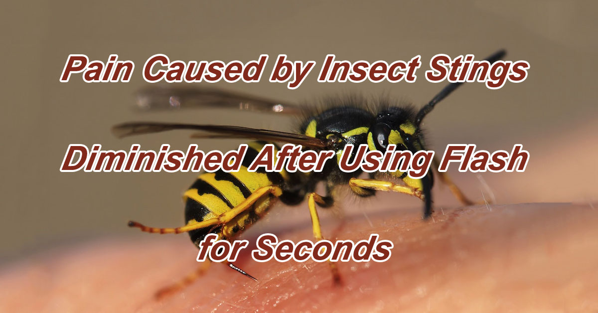 Pain Caused by Insect Stings Diminished After Using Flash for Seconds