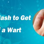 Use Flash to Get Rid of a Wart