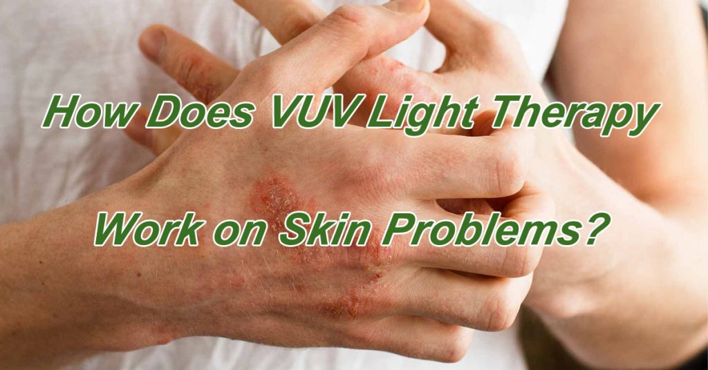 How Does VUV Light Therapy Work on Skin Problems