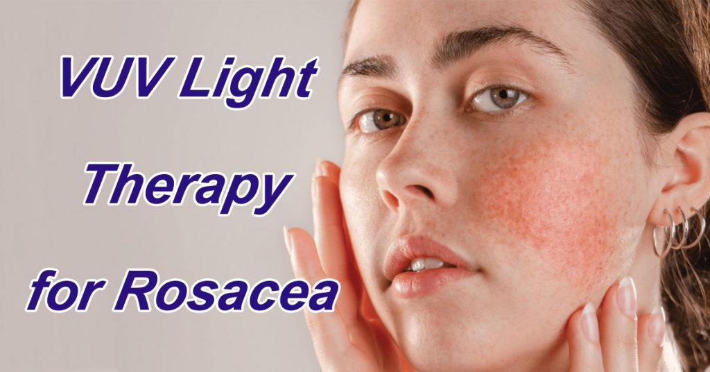 VUV Light Therapy for Rosacea