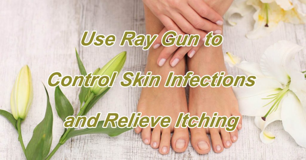 Use Ray Gun to Control Skin Infections and Relieve Itching