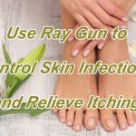 Use Ray Gun to Control Skin Infections and Relieve Itching