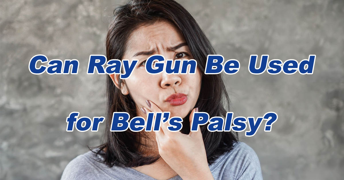 ¿Se puede utilizar la pistola de rayos para la parálisis de Bell?