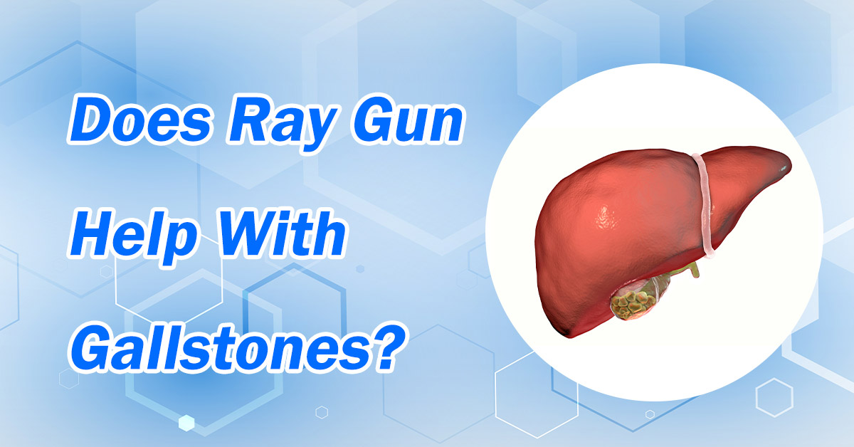 Does Ray Gun Help With Gallstones