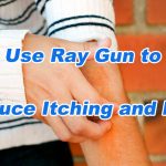 Use Ray Gun to Reduce Itching and Pain