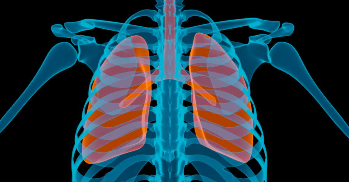 Low Field Magnetic Stimulation therapy helps with bronchitis by reducing inflammation and improving the immune system